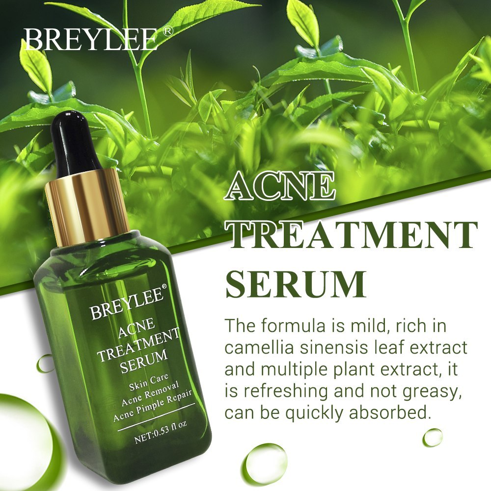 BREYLEE Anti-Akne Serum – Gesichtspflege gegen Akne & Pickel, mildert Aknenarben & Hautunreinheiten, mit Grüntee-Extrakt (30ml)