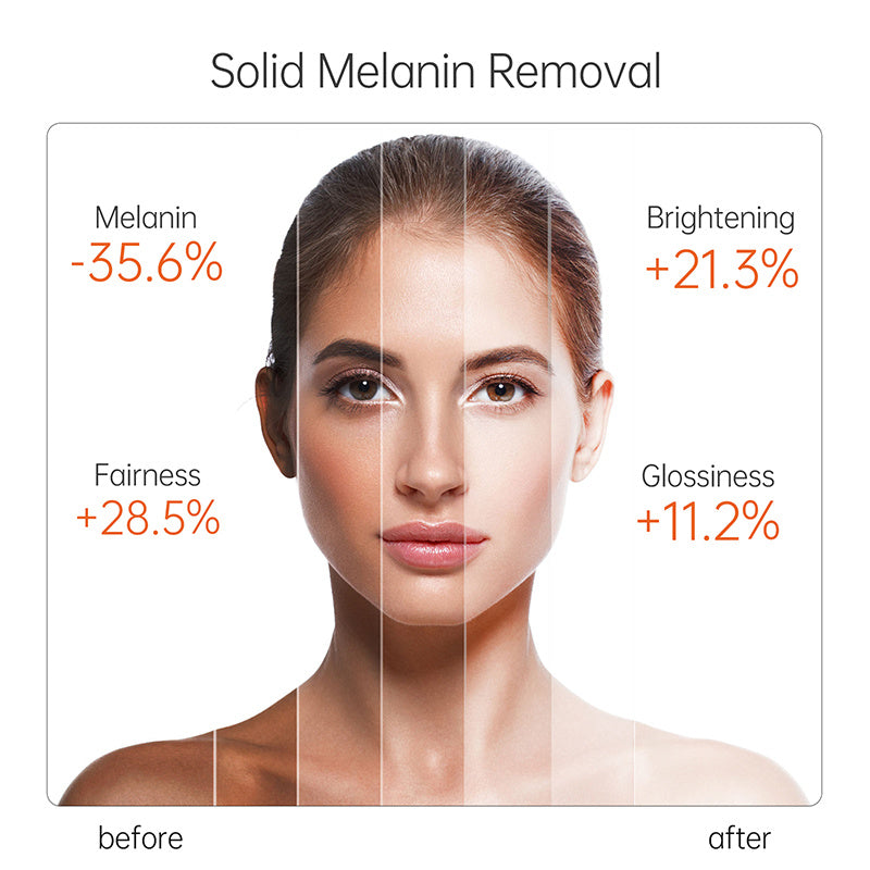 Vitamin C Serum 15ml – Feuchtigkeitsspendendes Anti-Aging Gesichtsserum | Gegen Pigmentflecken & für strahlende Haut